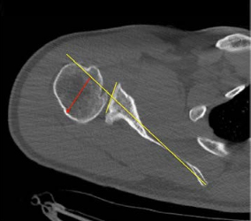 Diagnosis and  Imagin