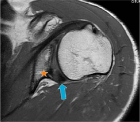 Diagnosis and  Imagin