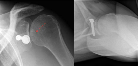 Incongruent or lateralized augmentation