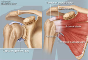 Rotator Cuff Tears