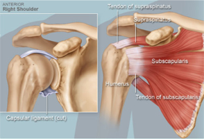 Rotator Cuff Tears