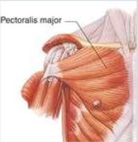 PEC major for Scapular Winging