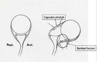 Shoulder Injury