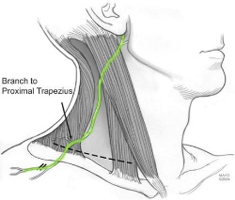 Trapezius Palsy