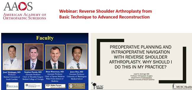 Dr. Eichinger recently presented a talk on Surgical Planning and Intraoperative Navigation for the American Academy of Orthopaedic Surgeons Webinar on Shoulder Replacement Surgery