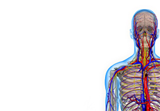 Thoracic Outlet Syndrome